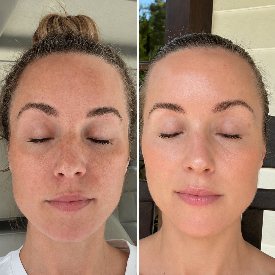 Résultat avant/après Bare Rituals® — teint unifié et peau plus ferme après cure Bare Collagen